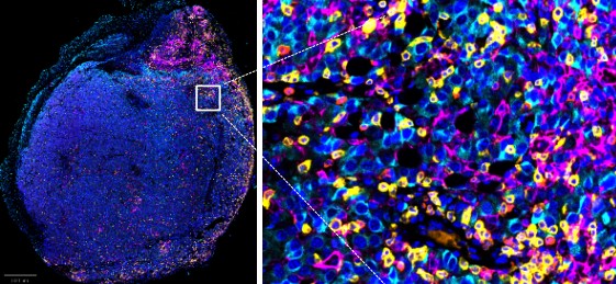 AOAH可以單獨發揮作用，亦能與現有免疫療法結合，產生協同效應，促進CD8+ T細胞和CD11c+樹突狀細胞的浸潤與激活，從而增強癌症免疫治療效果。
 